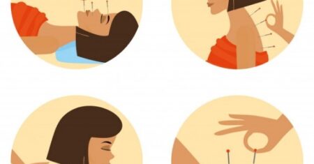 Série tratamentos e terapias – o que é acupuntura e seus benefícios
